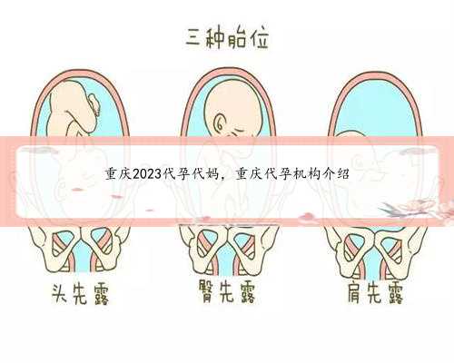 重庆2023代孕代妈，重庆代孕机构介绍