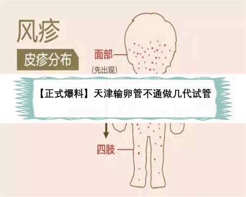 【正式爆料】天津输卵管不通做几代试管